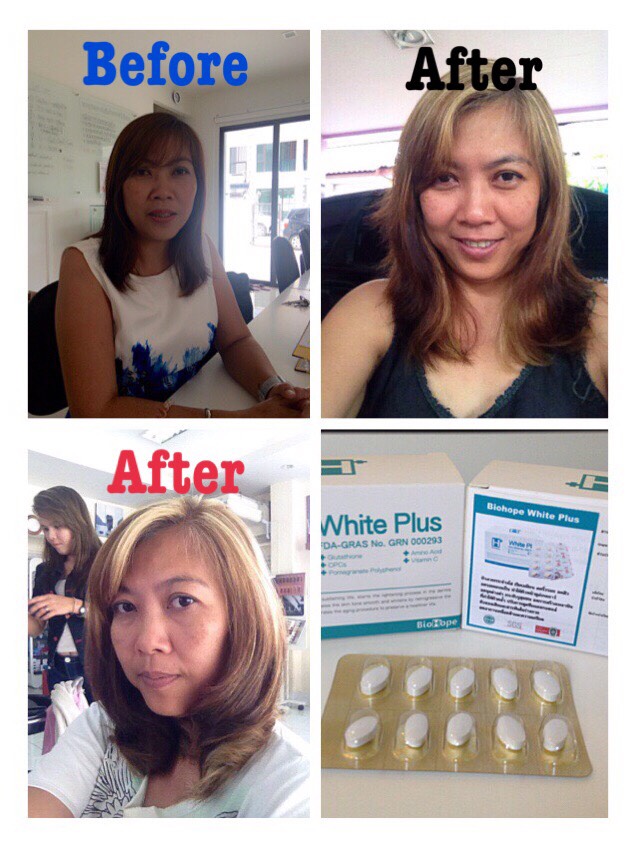 ผลการทานยาขาว White Plus จาก Biohope