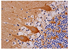 Recombinant Human Epidermal Growth Factor (อาร์เอชอีจีเอฟ) ช่วยลดอาการเกิดแผล